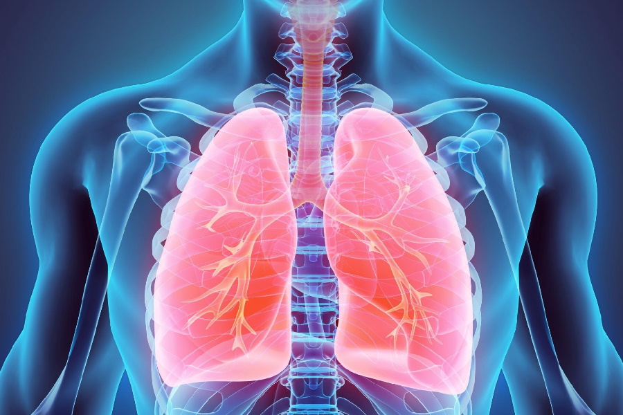 Câncer de pulmão: Conceito e seus efeitos