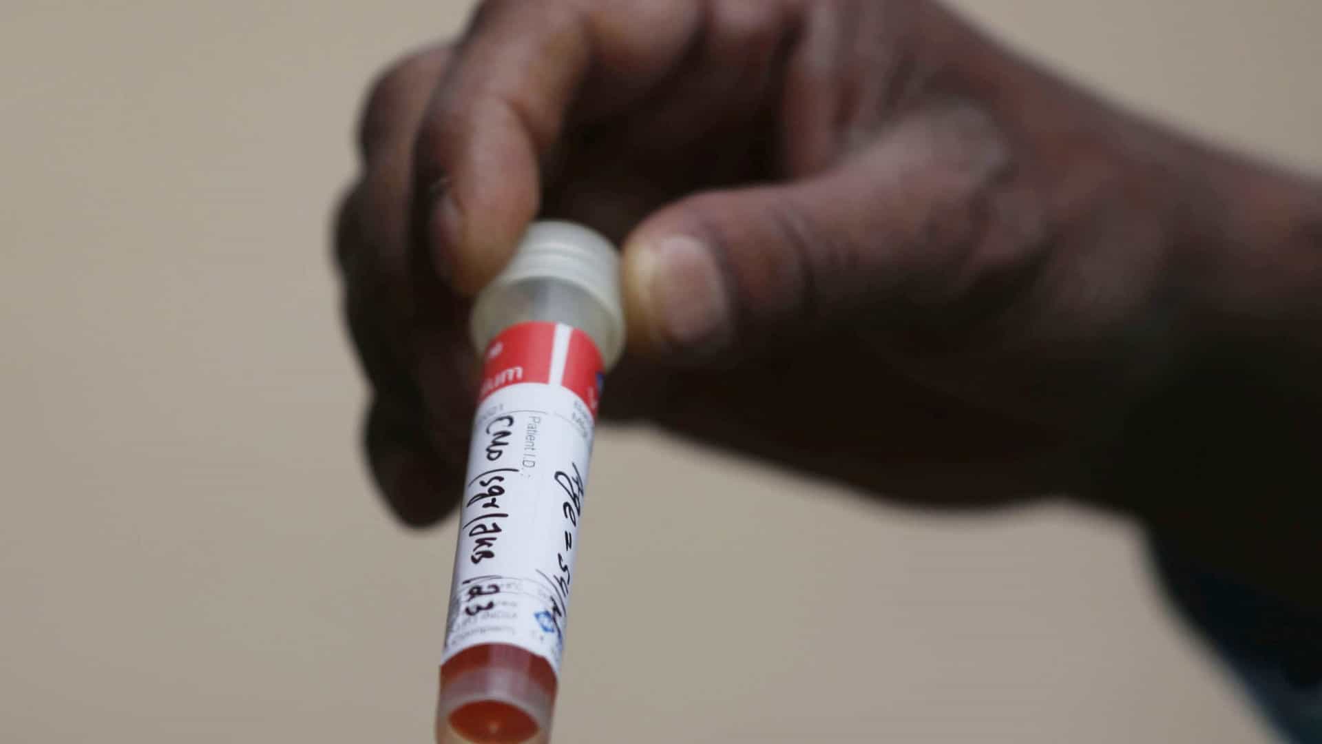Covid-19: Mais uma morte e 74 novos infetados em Moçambique
