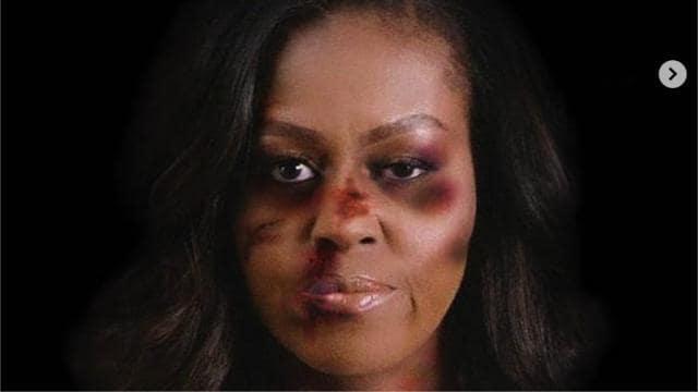 Celebridades: Michelle Obama desfigurada por hematomas, a imagem chocante contra a violência doméstica