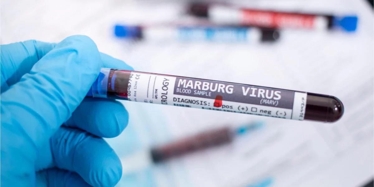 Vírus Marburg: Gana confirma os primeiros casos