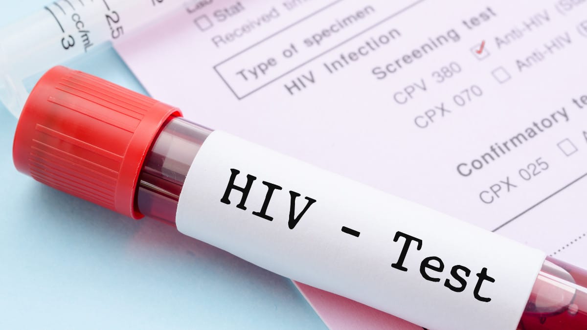 Moçambique: Outro homem potencialmente curado do Vírus da Imunodeficiência Humana (HIV)