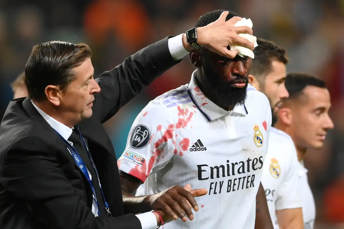 Futebol: Sangue, suor e lágrimas pelo Real Madrid, o heróico golo de Antonio Rüdiger na Liga dos Campeões