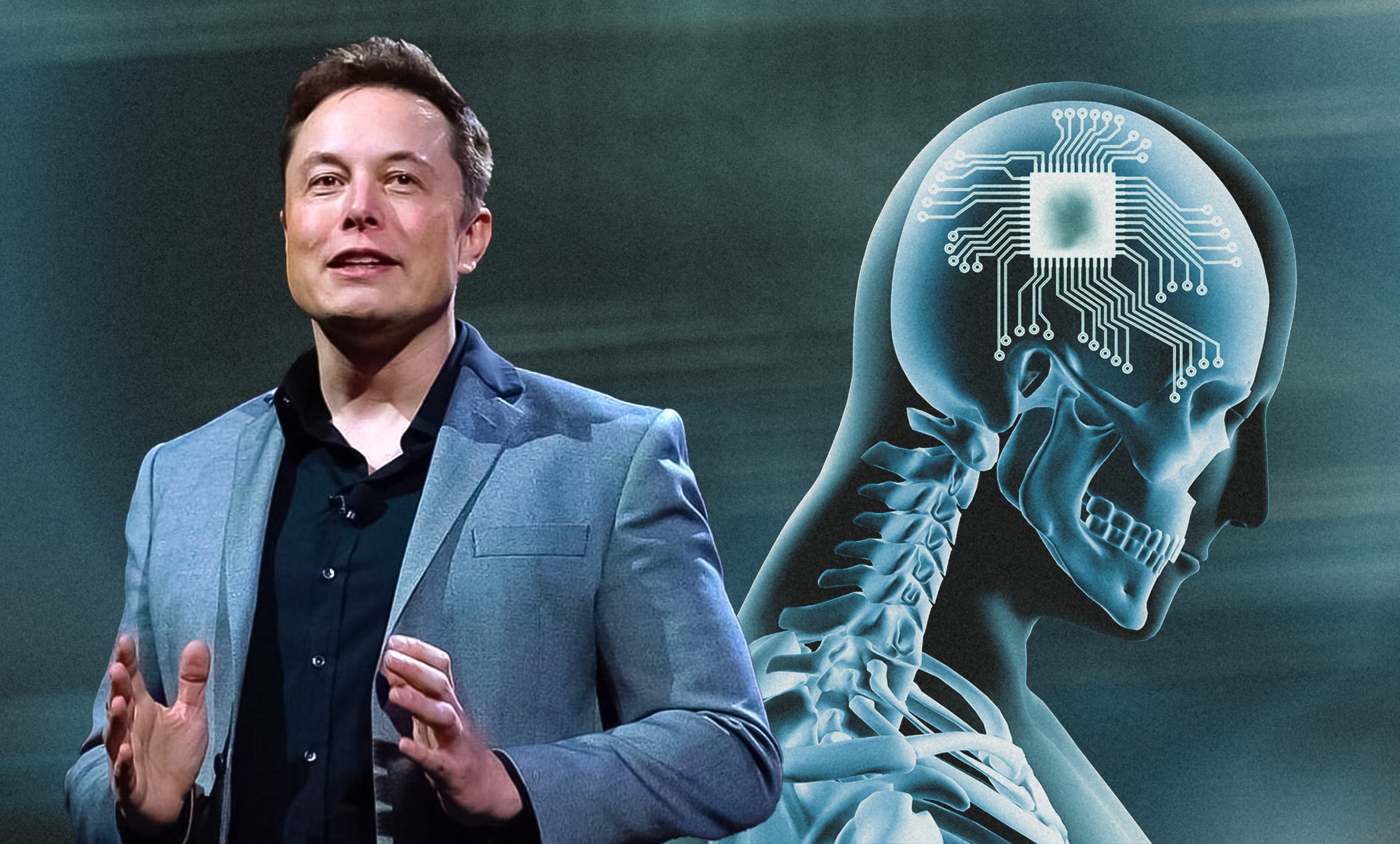 Saúde/Tecnologia: Elon Musk vai testar os seus implantes cerebrais conectados em humanos.