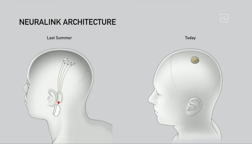 Saúde/Neuralink: O que é que a medicina do futuro nos reserva?