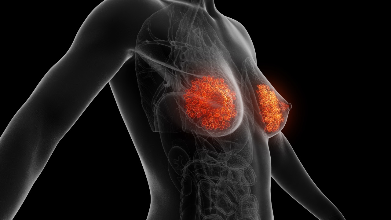 Saúde/Saúde da Mulher: “Bomba inteligente” oferece nova esperança no tratamento do cancro da mama metastático HER2-positivo