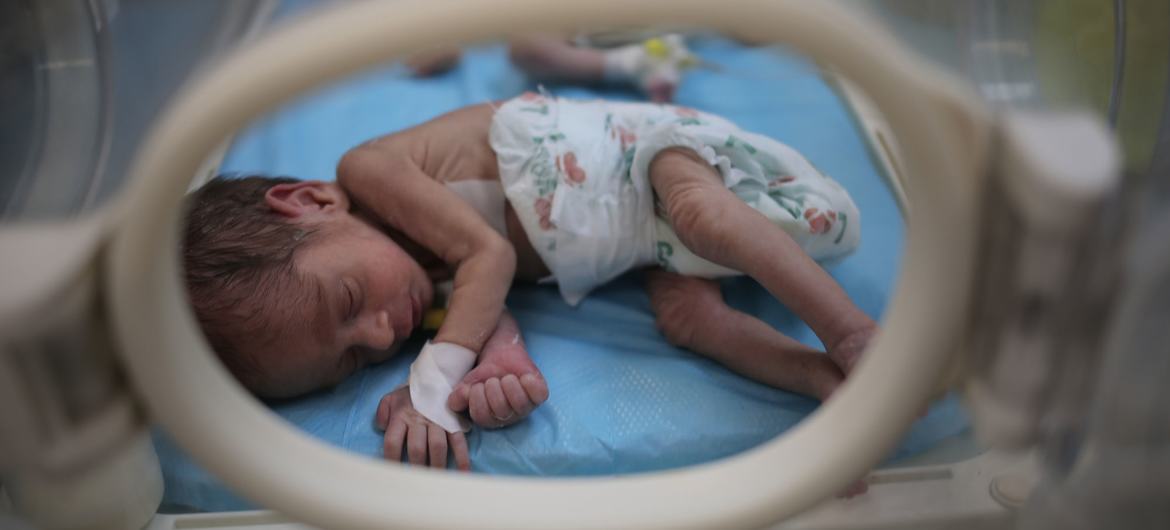 Internacional/Médio-Oriente: Gaza atinge níveis de fome extrema, Mais de 20 mil crianças hospitalizadas por desnutrição aguda